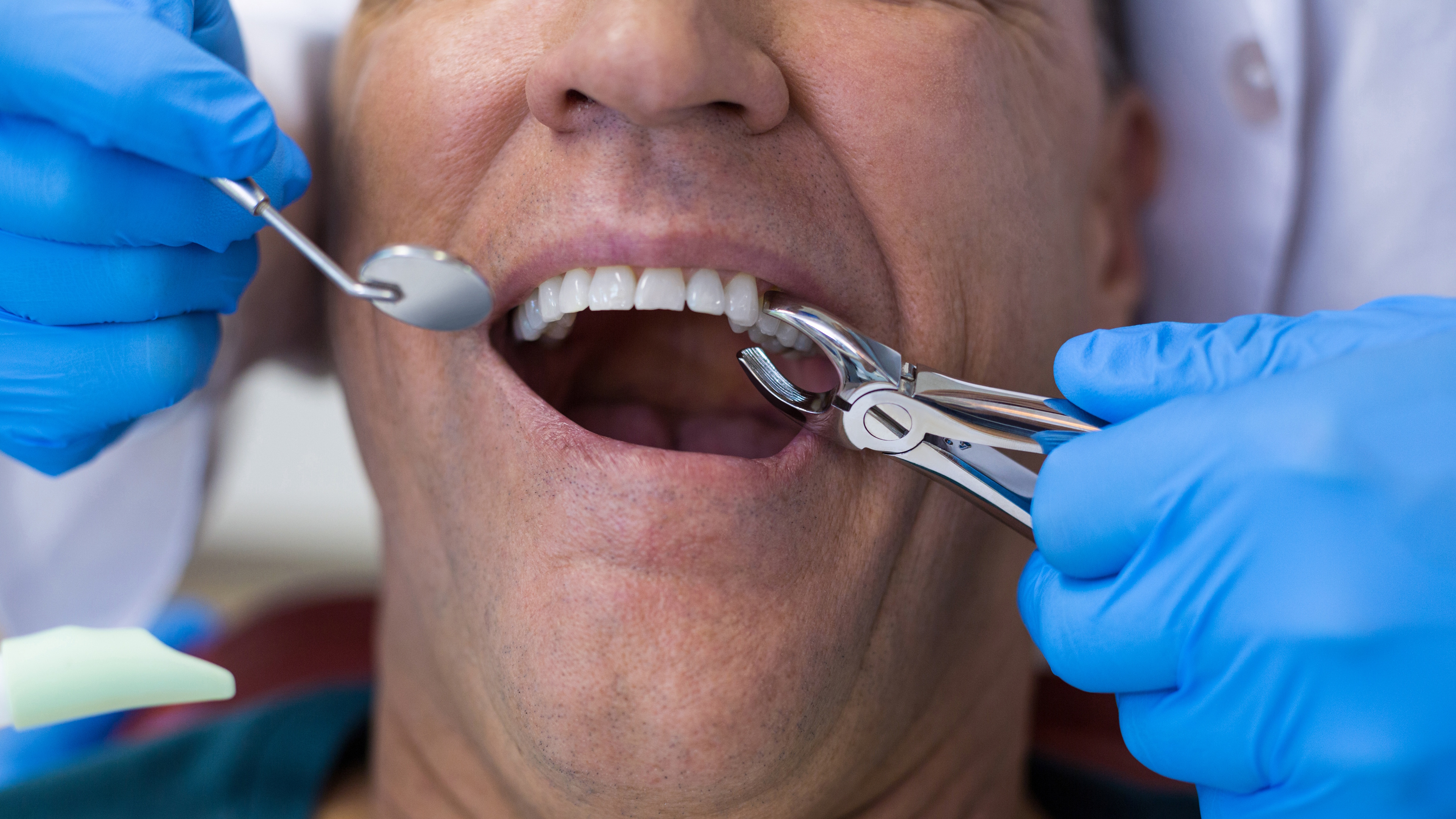 Indications for Tooth Extraction